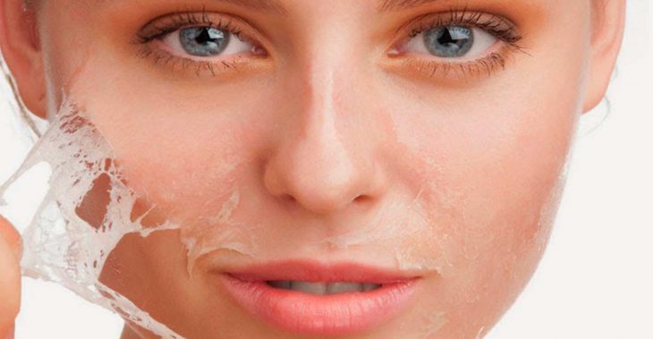 Cuidados de la piel después de un peeling químico